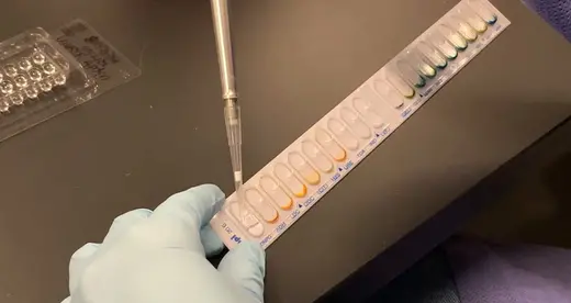 Pipette IMG 1414