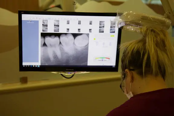 Screen showing x-ray of teeth